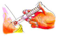 3. Si se tiene un suero antiavispa inyectarlo según
 las instrucciones indicadase